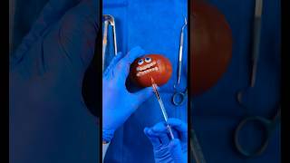 Emergency FruitSurgery Moldy Tomato gets attacked in FoodSurgery DiscountDentist Satisfying [upl. by Nuahsed800]