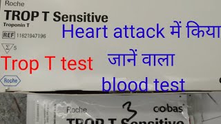 tropnin T test procedure  troponin t test method Trop t test for heart attack [upl. by Colin458]