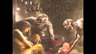 Amagortis  PreNatal Canibalism 2008 Full Album [upl. by Riesman2]