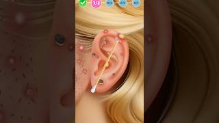 ASMR 👂 Ear Cleaning amp Treatment  Soothing Sounds for Deep Calm asmr soundmassage calmingsounds [upl. by Ygief3]