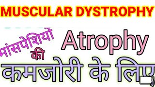 Muscular dystrophy Muscular atrophy symptoms [upl. by Richers]