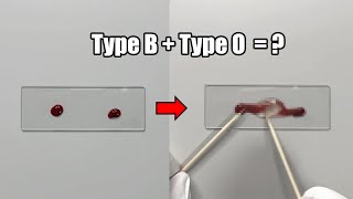 What Happens When Two Different Blood Types are Mixed Together [upl. by Gilder]