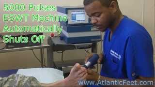 Plantar Fasciitis Treatment with ESWT Video [upl. by Gilburt179]