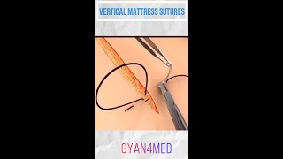 Vertical Mattress Suture  Best Suture Techniques [upl. by Ehr]