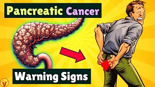 10 Warning Signs of PANCREATIC CANCER That Will SHOCK You  VisitJoy [upl. by Fredrick898]