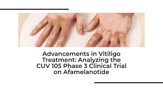 New HOPE for vitiligo  Phase 3 Clinical Trial of Afamelanotide amp Phototherapy  vitiligotreatment [upl. by Zebulen65]