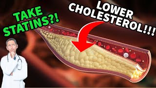 Lower Your Cholesterol  Steroids and Statins  Should You Take A Statin  Doctors Analysis [upl. by Herman]