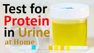 Test for Protein in Urine at Home  Urine Dipstick Test  Sriaas Kidney Treatment [upl. by Amitak598]