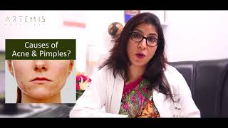 CAUSES OF ACNE amp PIMPLES [upl. by Olemrac153]