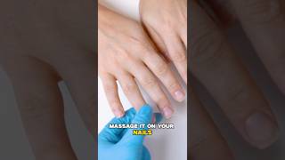 Nail Extension Gone Wrong  Remedy for Post Nail Care Treatment  Dr Nitika Kohli [upl. by Ferneau340]