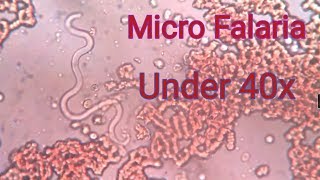 Falaria under 40x microscope [upl. by Tur]