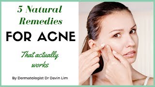 How to treat acne naturally  dermatologist explains [upl. by Erdah]