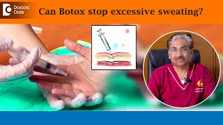 Can Botox STOP excess hand sweatingHyperhidrosisSweaty PalmsDrVenkataram MysoreDoctors Circle [upl. by Javier]