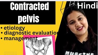 Contracted pelvis etiology Robert pelvis  Naegles pelvis  diagnosis management Hindi [upl. by Rolandson]