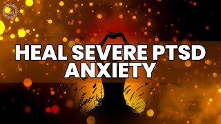 Heal Severe PTSD Anxiety IBS and Depression  Overcome Pain and Sleep Problems  Binaural Beats [upl. by Ordnagela507]