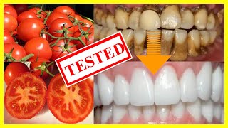 HOW TO Whiten Teeth At Home NATURALLY Only 3 minutes using Tomato 2020 [upl. by Hultgren]