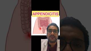 Acute Appendicitis Symptoms and treatment appendicitis appendix [upl. by Mann]