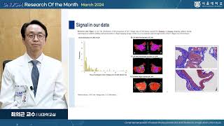 SNU MEDICINE 이달의 연구 2024년 3월 내과학교실 최의근 교수님클론성 조혈증과 심방세동동아시아 코호트 연구 [upl. by Nakhsa]