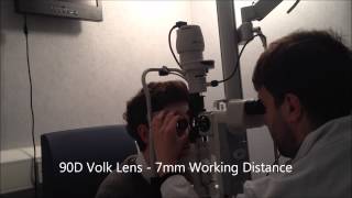 Indirect Ophthalmoscopy with Volk Lens [upl. by Pitt]