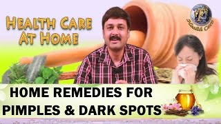 HOME REMEDIES FOR PIMPLES ACNE AND DARK SPOTSII कील मुहासों और काले धब्बो का घरेलू उपचार II [upl. by Timon347]