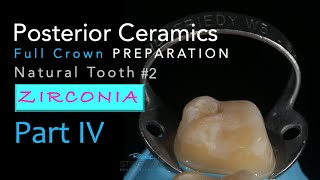 Zirconia Ceramics Part 4 AllCeramic Crown Preparation 2 Natural Tooth [upl. by Nolad]