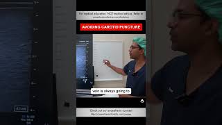 Avoiding Carotid Puncture  shorts cvc anesthesiology nurse [upl. by Maxima]