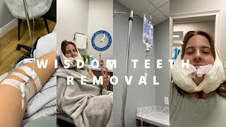 my wisdom teeth removal vlog 🦷 pre care anesthesia recovery amp more [upl. by Aredna610]