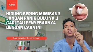 HIDUNG BERDARAH⁉️ JANGAN PANIK  BERIKUT CARA MENGATASI HIDUNG BERDARAH DIRUMAH [upl. by Heaps]