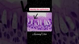 Pseudostratified Epithelium  Histology  Microanatomy anatomy neetpg mbbs histology neetmcqs [upl. by Rimisac]