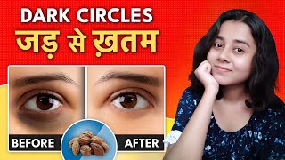 Dark Circles को Permanently हटाएँ  Best Home Remedy to Remove Dark Circles Permanently in 1 Week [upl. by Revell]