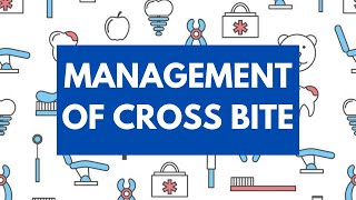 Management of Cross Bite Orthodontics [upl. by Nylednarb]