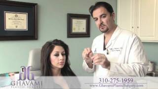 Custom Ethnic hispanic Rhinoplasty By Dr Ghavami [upl. by Lull286]