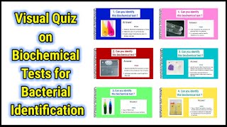 Visual Quiz on Biochemical tests for identification of bacteria  basicappliedmicrobiology [upl. by Neyugn]