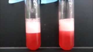 DNA Extraction Strawberry [upl. by Grearson]