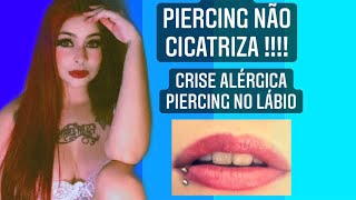 PIERCING NA BOCA  NÃO CICATRIZA E AGORA INFLAMOU [upl. by Anabella]