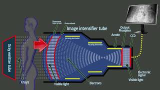 Fluoroscopy  Xray intensifier tube  Basic functions [upl. by Aleunam]