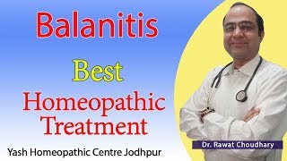 Balanitis  Best Treatment of Balanitis  Best Homeopathic Doctor in India [upl. by Eseuqram437]