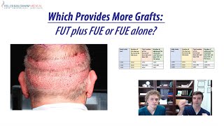 FUT or FUE Which Gives You More Hair  Feller amp Bloxham Hair Transplant  NY NYC Long Island [upl. by Chemar]