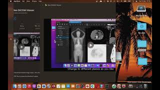 Bee DICOM Viewer Mac App Store Basic Overview [upl. by Eibrad]