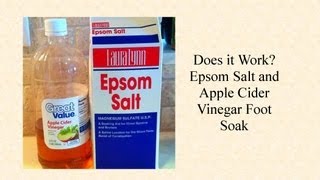 Does It Work Epsom Salt and Apple Cider Vinegar Foot Soak [upl. by Mushro]