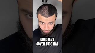 How to cover your baldness [upl. by Shaughnessy]