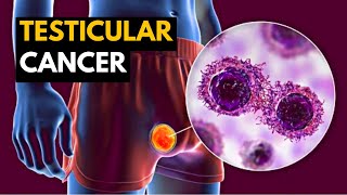 Testicular Cancer Causes Signs and Symptoms Diagnosis and Treatment [upl. by Isolde]