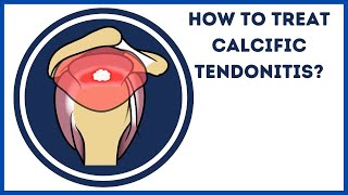 How to treat calcific tendonitis [upl. by Weinman]