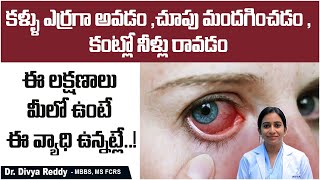 Uveitis Causes Symptoms and Treatment In Telugu  కంటిలో నల్ల మచ్చలు  Best Vision Eye Hospital [upl. by Alekehs749]