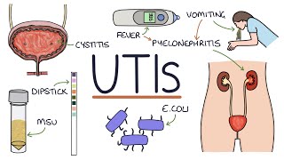 Understanding Urinary Tract Infections [upl. by Stroud639]