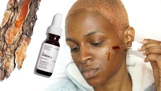 The Ordinary Pycnogenol 5 Review  BeautyFrenzyBlog [upl. by Gaskin200]