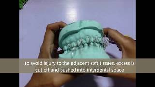 Interdental Wiring and Intermaxillary Fixation [upl. by Siraval]