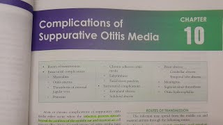 Complications of Suppurative Otitis Media  ENT [upl. by Agamemnon666]