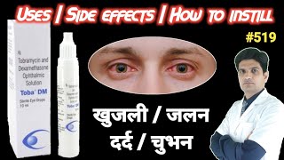 Tobramycin dexamethasone eye drops  Toba dm eye drops uses in hindi  Tobradex eye drops use [upl. by Llibyc]