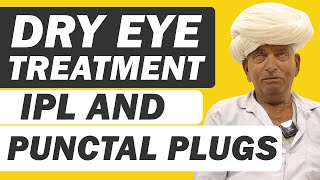 आंखो मे सूखापन Dry Eyes का इलाज  Punctal Plugs and IPL Treatment for Eye Dryness at Eye7 Hospital [upl. by Colan]